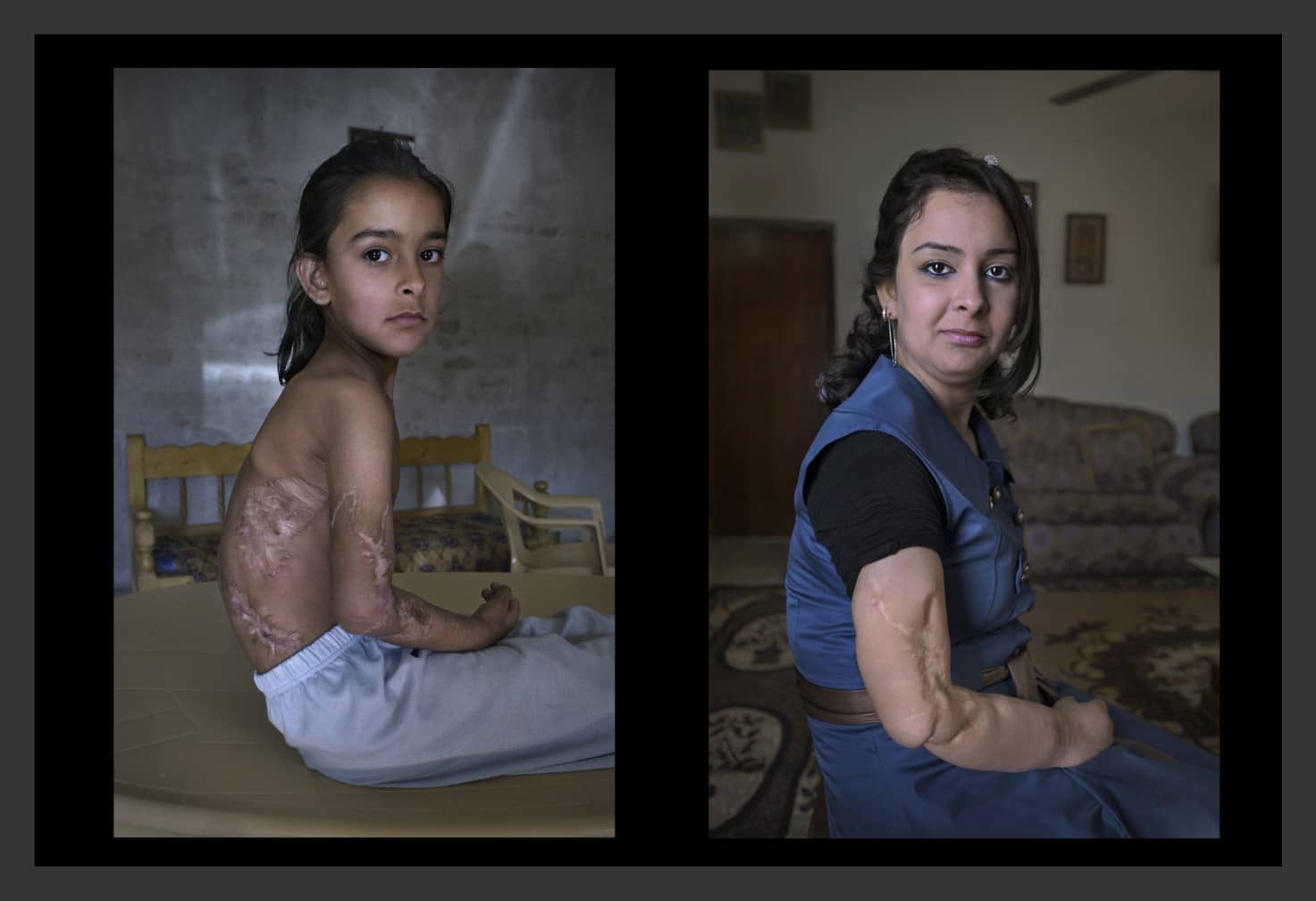 Mawj al Obaidi, mujer herida en la guerra